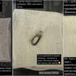 У Тернополі медики виймали зі шлунків дітей незвичні речі