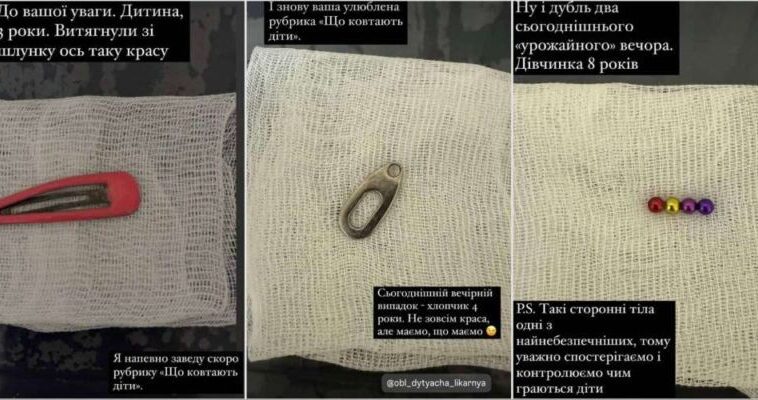 У Тернополі медики виймали зі шлунків дітей незвичні речі