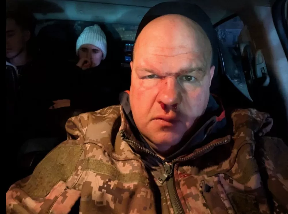 У Кременці двоє місцевих підприємців побили офіцера ЗСУ - відео бійки