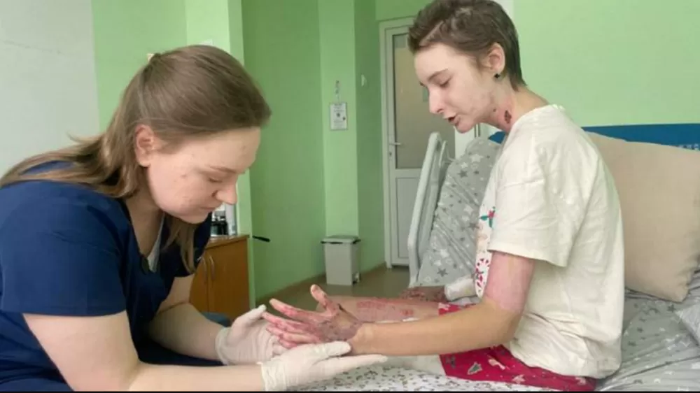 З лікарні у Львові виписали 14-річну Настю, яка постраждала від ракетного удару у Тернополі