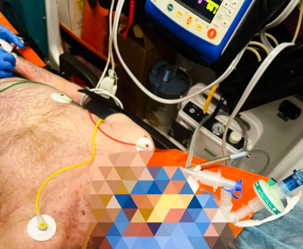 У Тернополі медики врятували чоловіка, в якого зупинилось серце