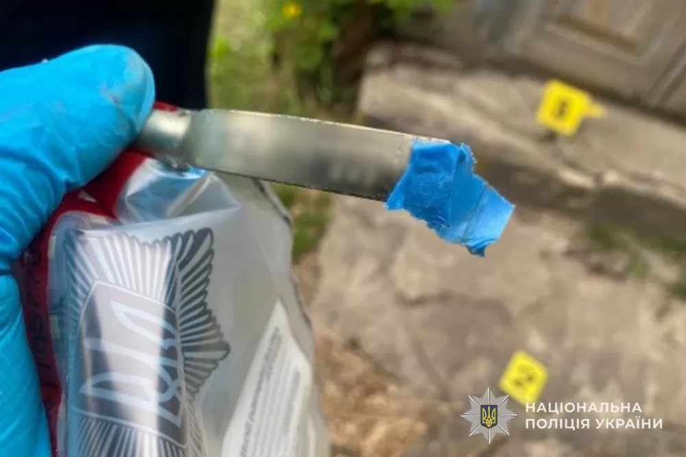 Вибух у Кременці: чоловік втратив пальці через вибух запалу гранати