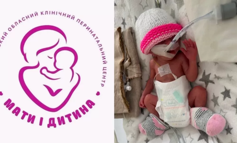 Всього 660 грамів: у Тернополі в лікарні виношують передчасно народжену дівчинку